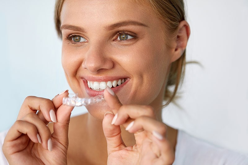 Invisalign Saskatoon  Invisible Braces Saskatoon - Midtown Dental